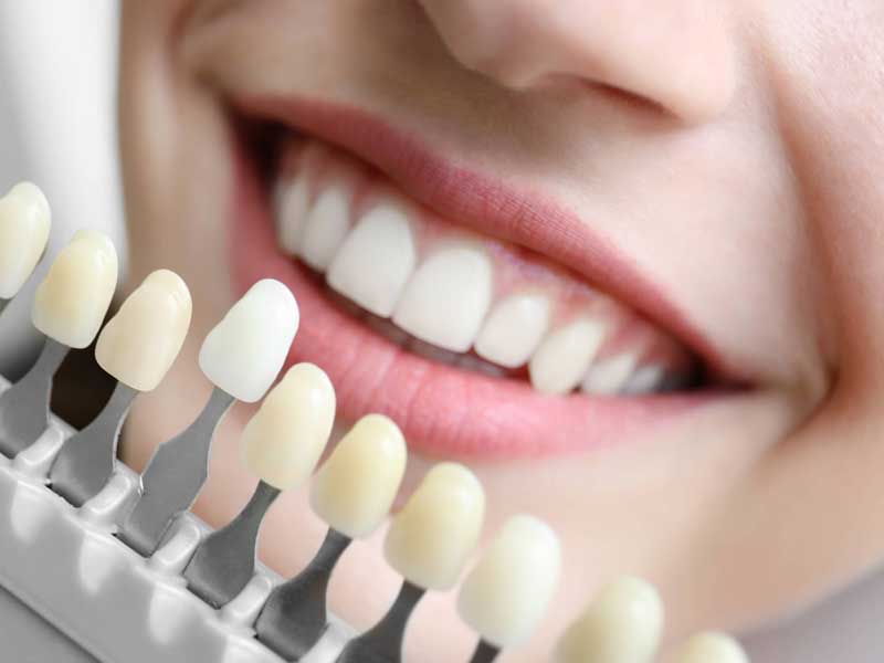 Dentista em Florianópolis Restauração Estética