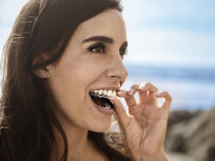 Aparelho Dentário Invisível Invisalign em Florianópolis