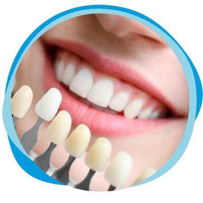 Restauração Dente Clínica Odontológica Florianópolis Dentista Dentária