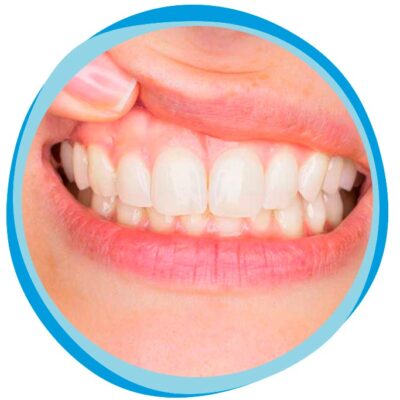 Periodontia em Florianópolis Clínica Odontológica Dentária Dentista